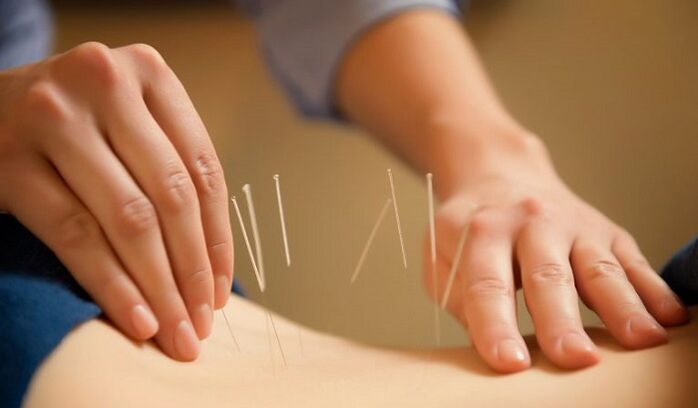 akupunktura k léčbě bolesti dolní části zad